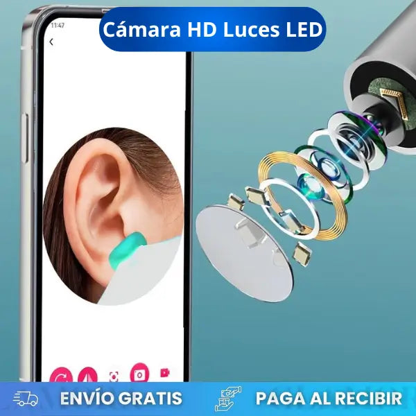 Limpiador y Visor de Oidos OtoView