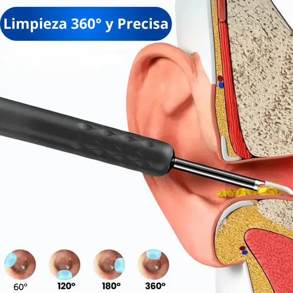 Limpiador y Visor de Oidos OtoView