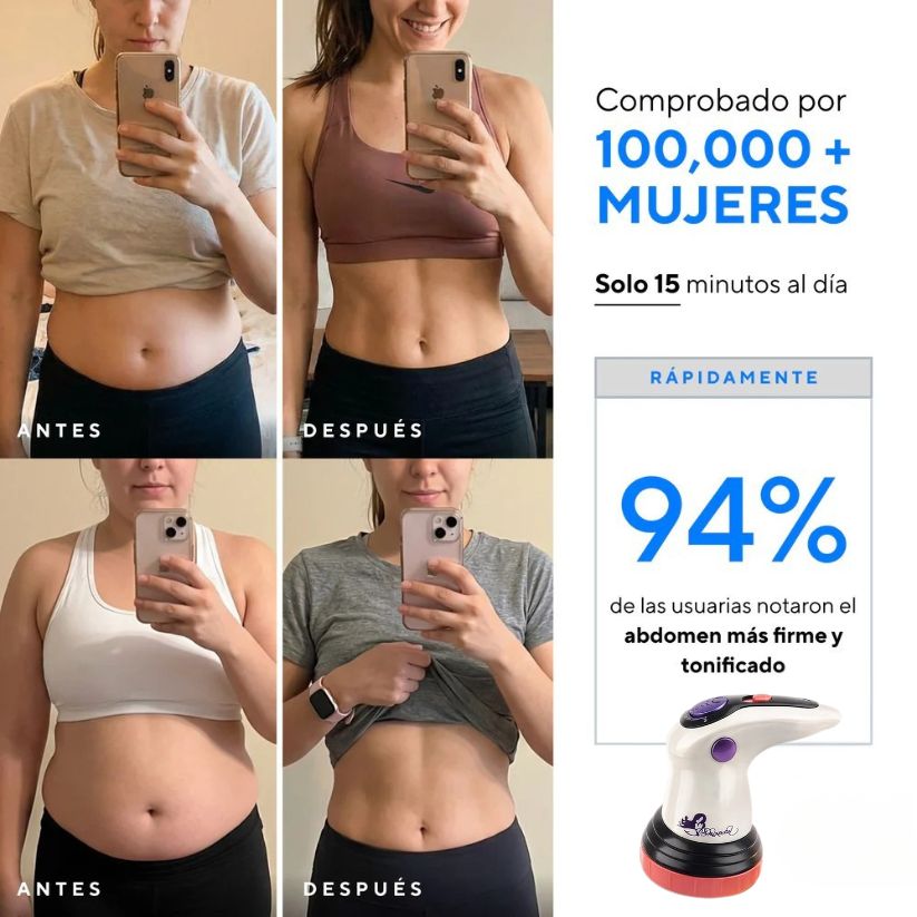 Masajeador Anti Celulitis BodySculpt