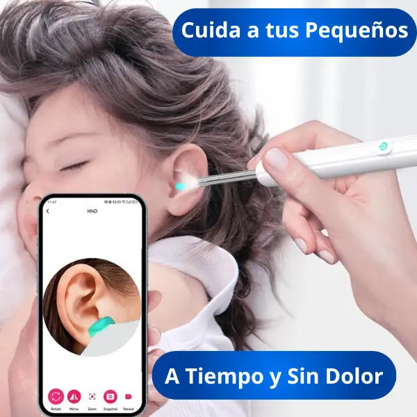 Limpiador y Visor de Oidos OtoView